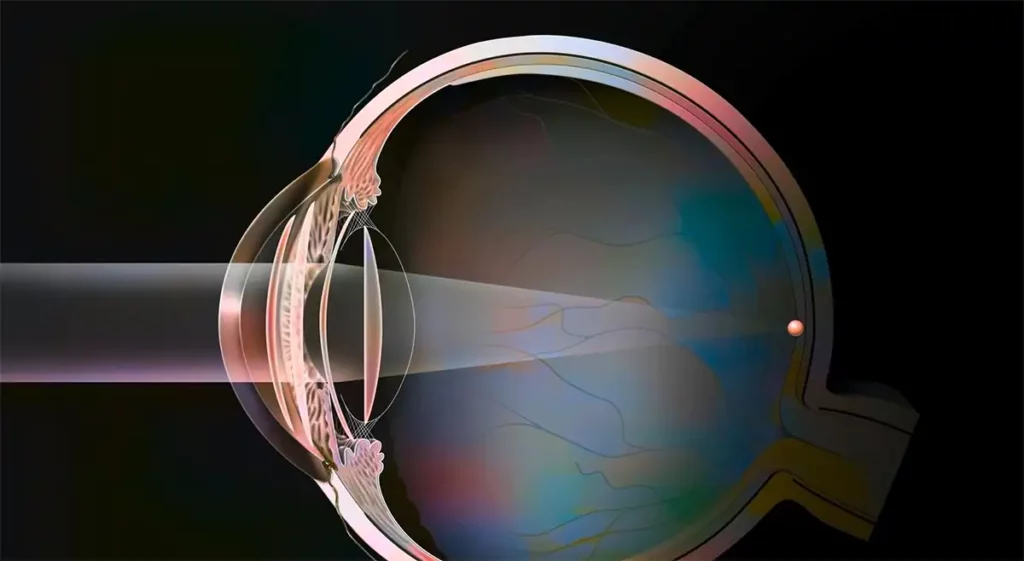 Neuralink će predstaviti implantat za vid na “show and tell” događaju